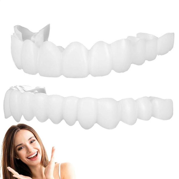 IMPORTED Snap-On Teeth Veneers